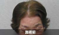 ��ި�����瑕���O