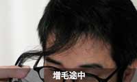 増毛途中